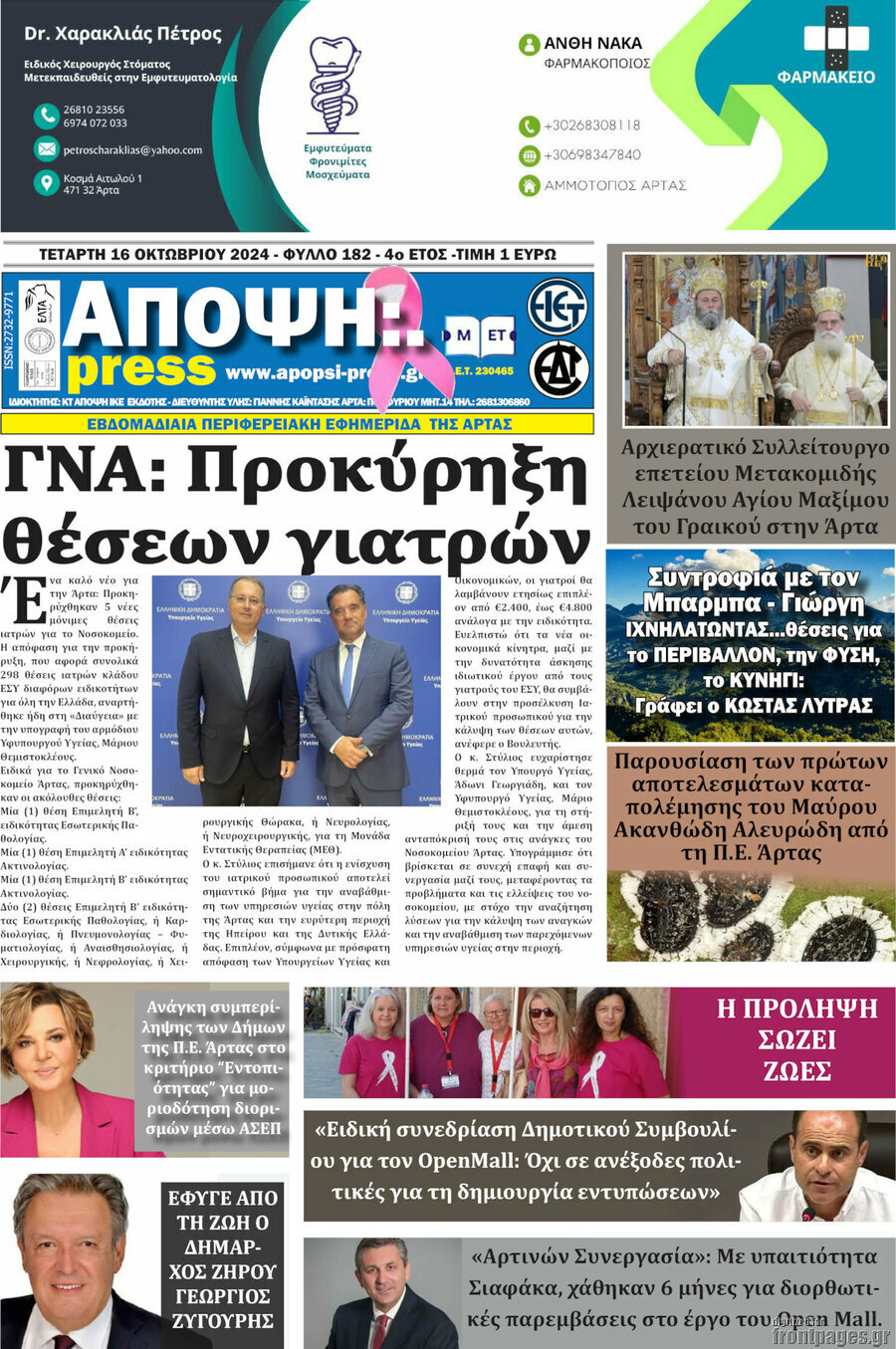 Άποψη